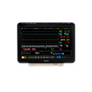 IntelliVue Patient Monitor MX800