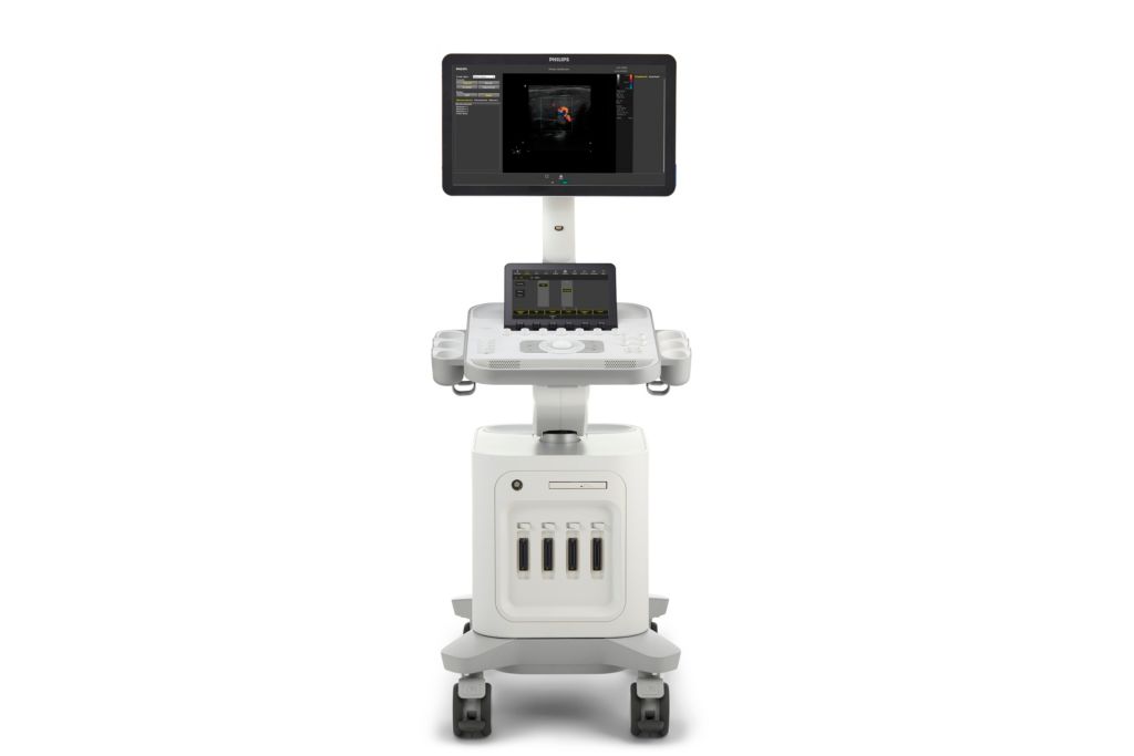 Philips 3300 front photo straight