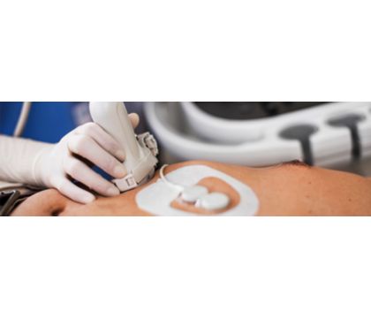 EPIQ ultrasound clinical application photo
