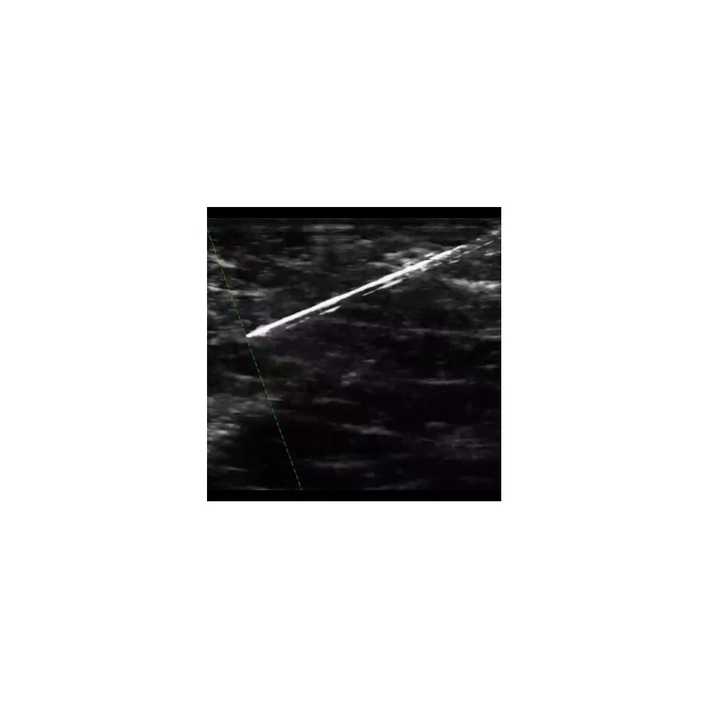 Visuzlize needles prominently