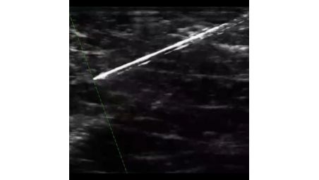 Visualize needles prominently