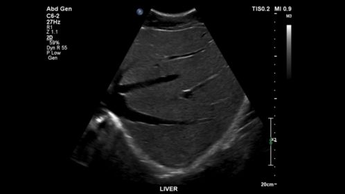 Liver