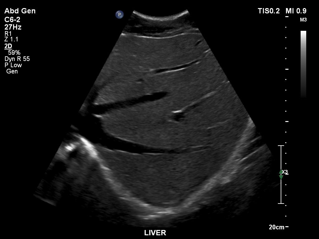 Liver