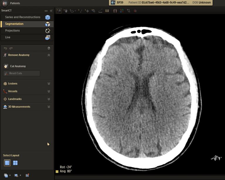 Stroke care clinical image