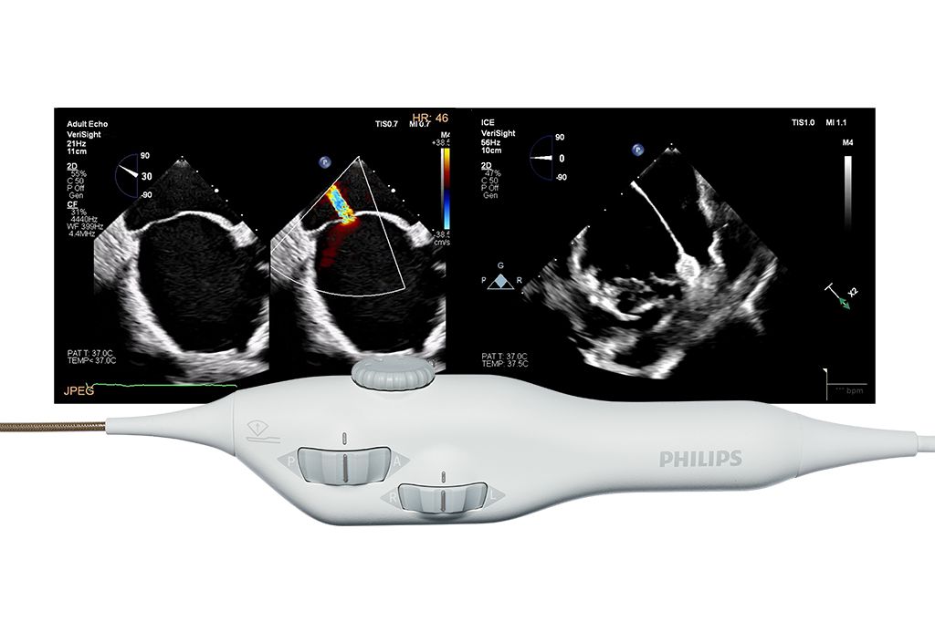 VeriSight Single Plane Steerable ICE Catheter - Philips - Philips