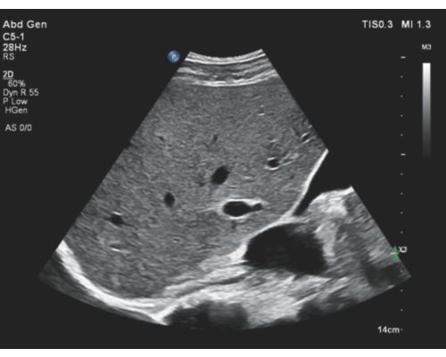 Ultrasound web NextGen Autoscan Gen Liver Gallbladder