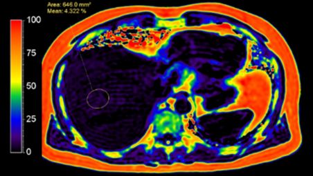 Tecniche affidabili per un imaging di routine di qualità