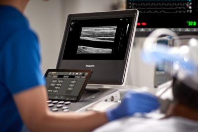 نظام Philips Compact Ultrasound System 5000 series قيد الاستخدام السريري