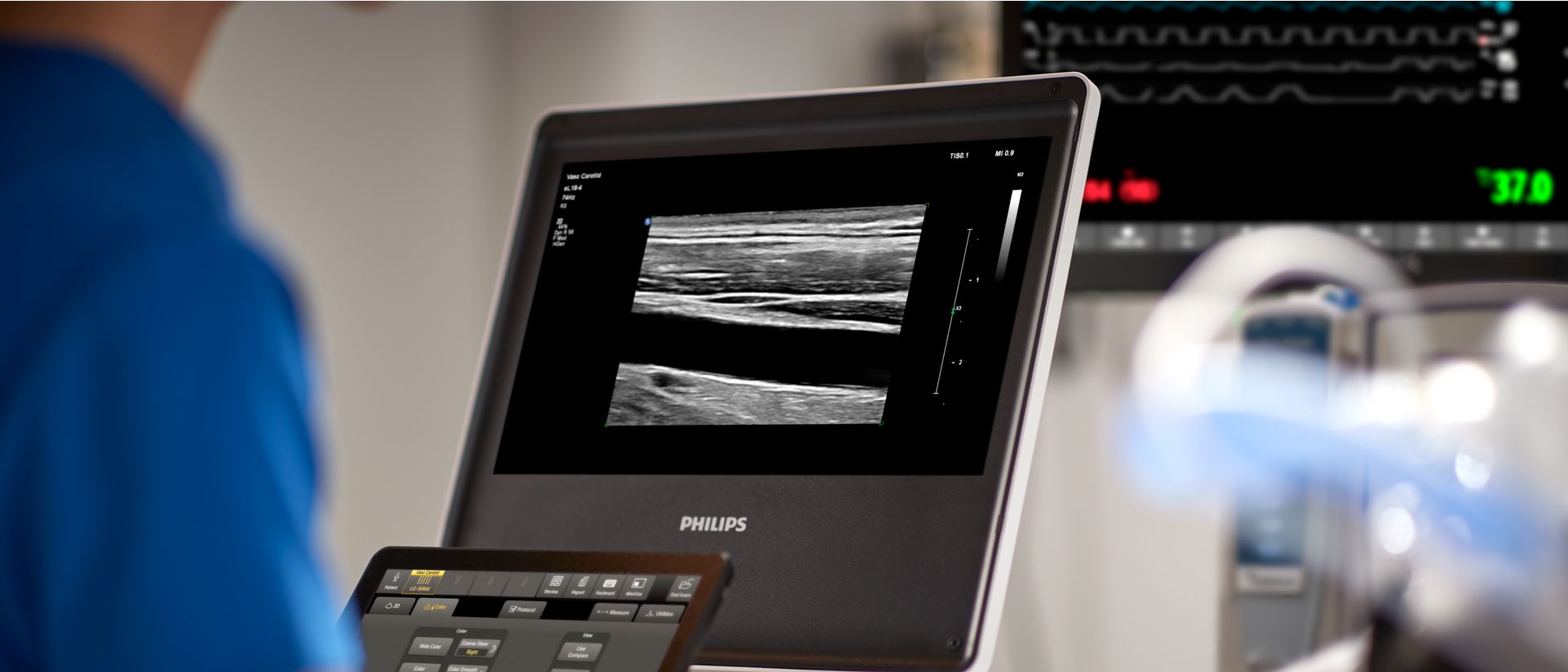 profesional de la salud usa equipo de ultrasonido compact 5000
