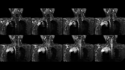 3D NerveVIEW