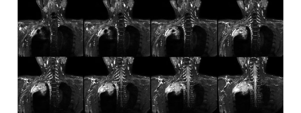 3D NerveVIEW