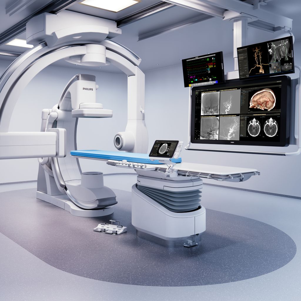 Acquisition of two consecutive contrast-enhanced CBCT (angio) scans of the brain to identify vessel occlusions and collaterals.