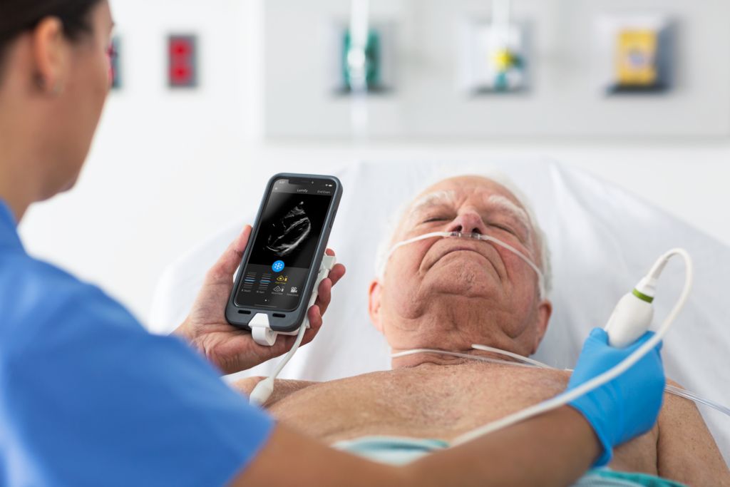 Lumify iOS transducers and accessories connected to iOS device