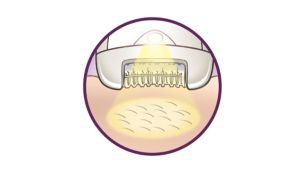 La lumière Opti-light révèle les poils les plus fins