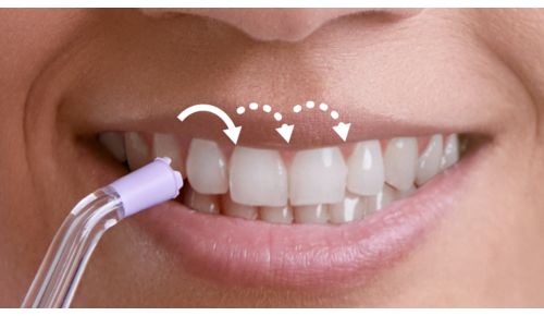 Pulse Wave-teknologi guider dig fra tand til tand