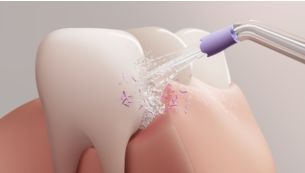 Quad Stream technology: Gentle yet effective plaque removal