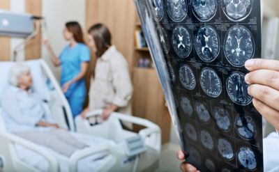 Médico sosteniendo imágenes de escáner cerebral junto al paciente en la cama del hospital