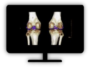 CT Dual Energy Viewer Visualize data from dual-energy acquisition​