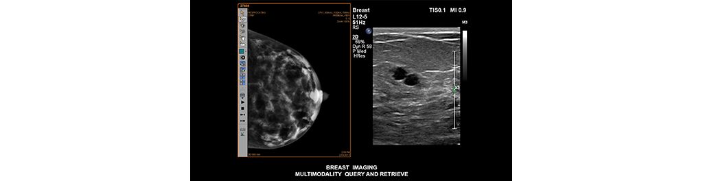 Service DICOM Query & Retrieve (Requête et Extraction)