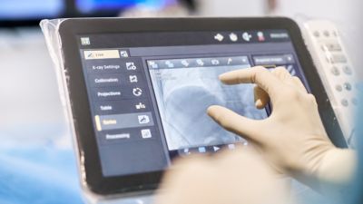 Clinician using touchscreen to navigate X-ray imaging during procedure