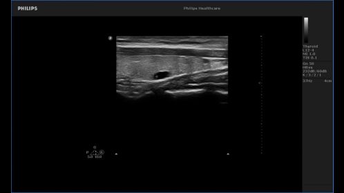 Thyroid image