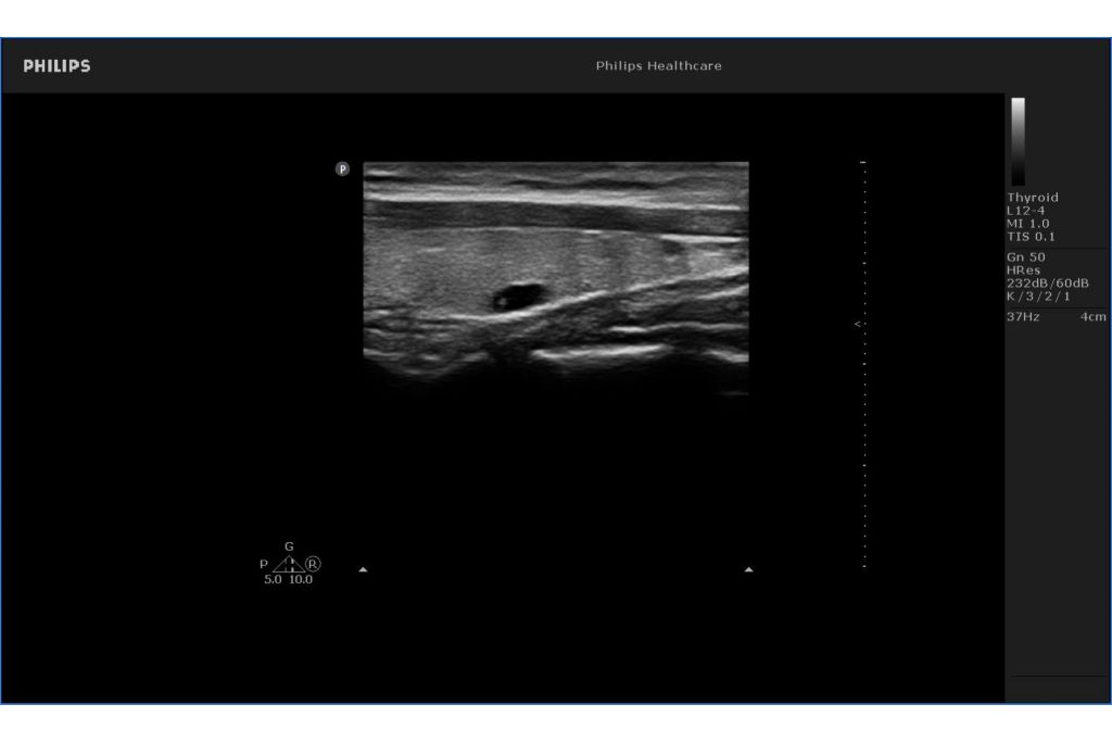 Thyroid image