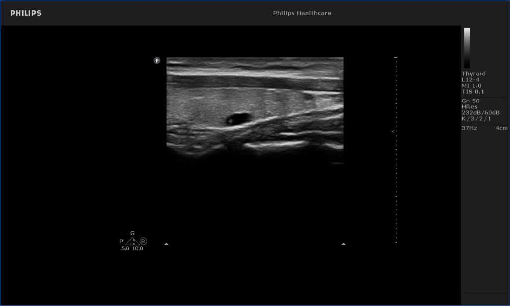 Thyroid image