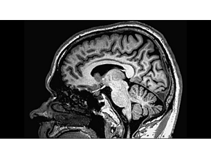 3D Non-selective – Gehirn Klinische MR-Anwendung