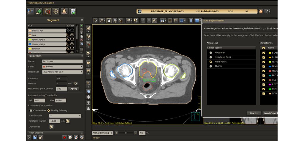 Comprehensive SPICE auto-contouring tools run directly within the contouring workspace to help streamline workflow.