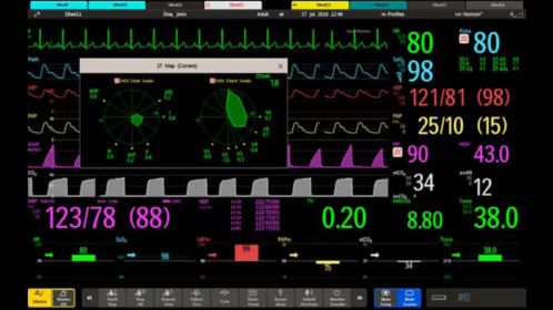 Buy Philips IntelliVue M40 M8003A Patient Monitor Online