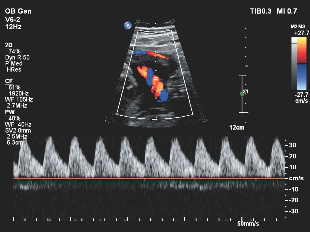 Affiniti 30 ultrasound clinical image obstetric