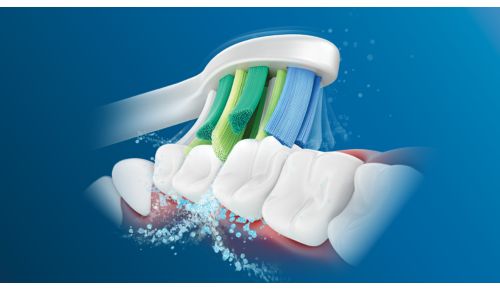 Die fortschrittliche Philips Sonicare-Schalltechnologie