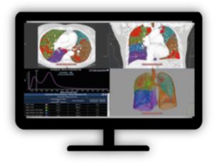 CT Chronic Obstructive Pulmonary Disease (COPD) Quantify diffuse lung disease