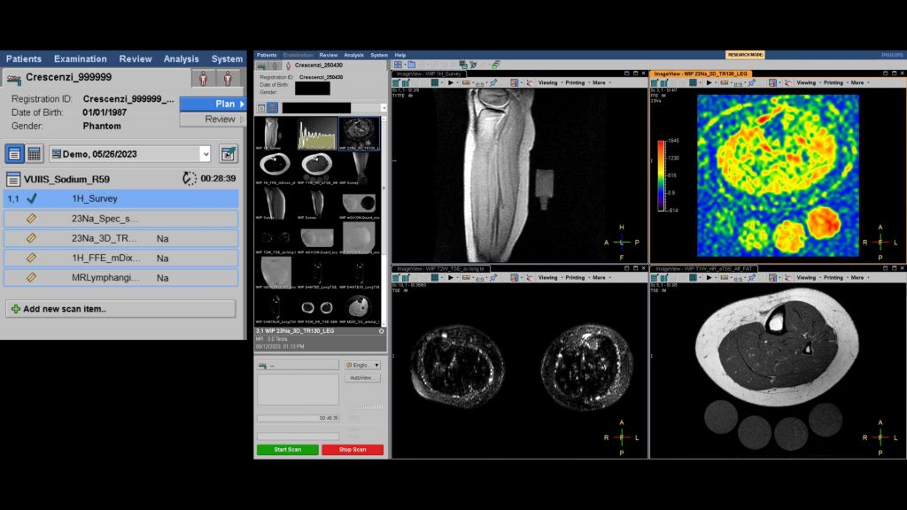 Multi-nuclear MRI ExamCard and review