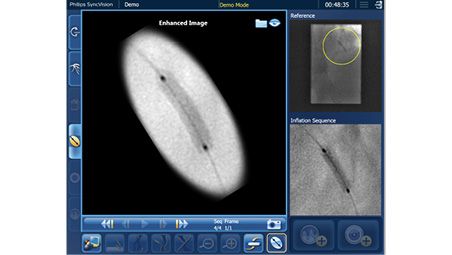 Inflado de dispositivos con Angio+