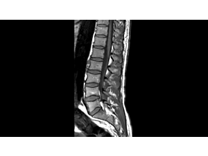 SmartSpeed - Spine MR Clinical Applications