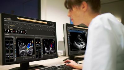 Doctor working in cardiovascular workspace with screen
