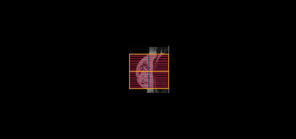 SmartExam Breast