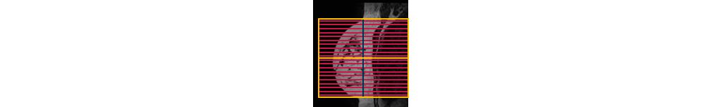SmartExam Breast