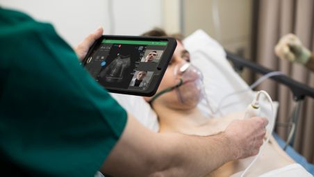 Auto B-line Quantification for lung assessment