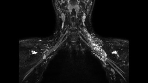 3D NerveVIEW