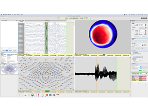 Net Station software EEG acquisition, review, and analysis software