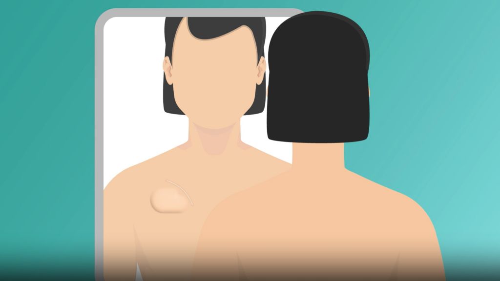 Cardiac patient (illustration) looking in mirror