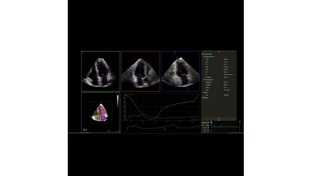 Dynamic HeartModel