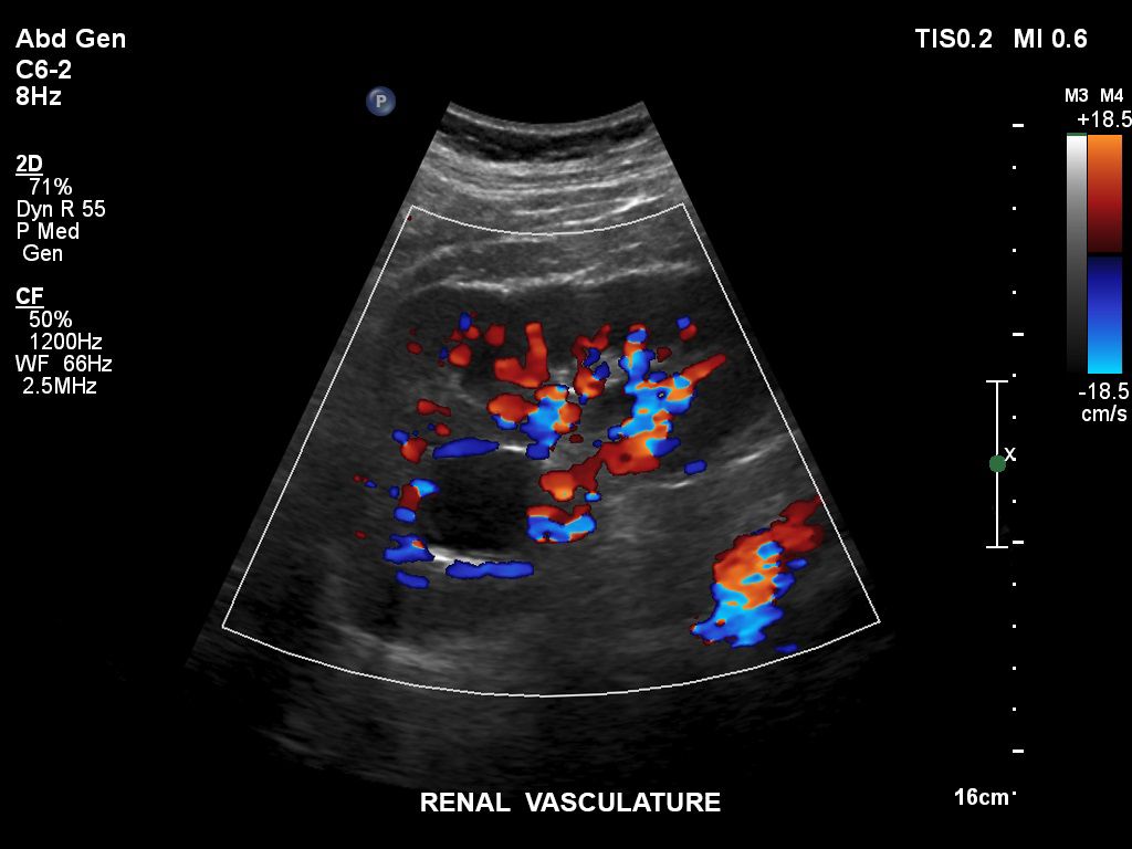 Renal vasculature