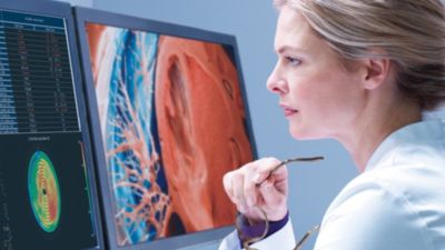 Un profesional médico revisando datos de imágenes médicas en una estación de trabajo de IntelliSpace Portal