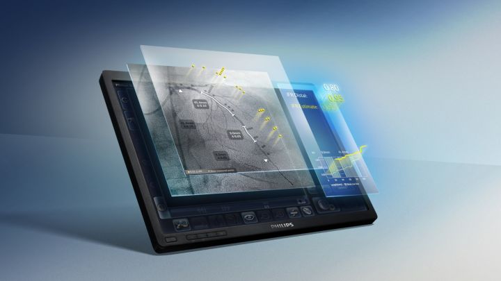 Philips iFR Co-registration