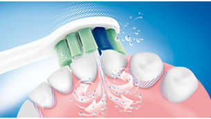 Tecnología patentada de cepillo dental Sonicare