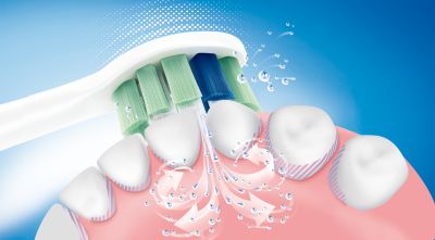 Tecnología patentada de cepillo dental Sonicare