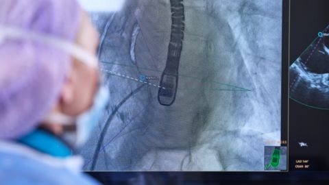 Structral heart disease measurements